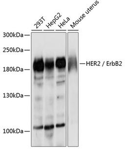 Western blot - HER2 / ErbB2 antibody (A2071)