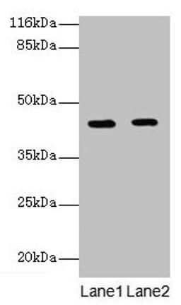 Western blot. All lanes: GFOD2 antibody at 2µg/ml. Lane 1: K562 whole cell lysate. Lane 2: Hela whole cell lysate. Secondary. Goat polyclonal to rabbit IgG at 1/10000 dilution. Predicted band size: 43, 31, 13 kDa. Observed band size: 43 kDa