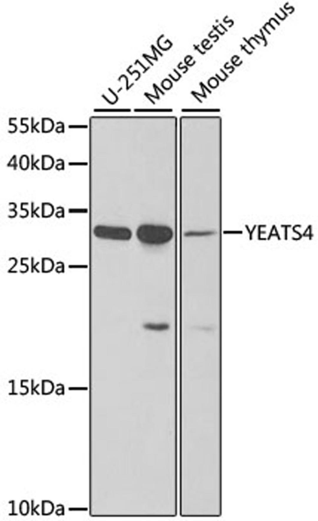 Western blot - YEATS4 antibody (A6318)