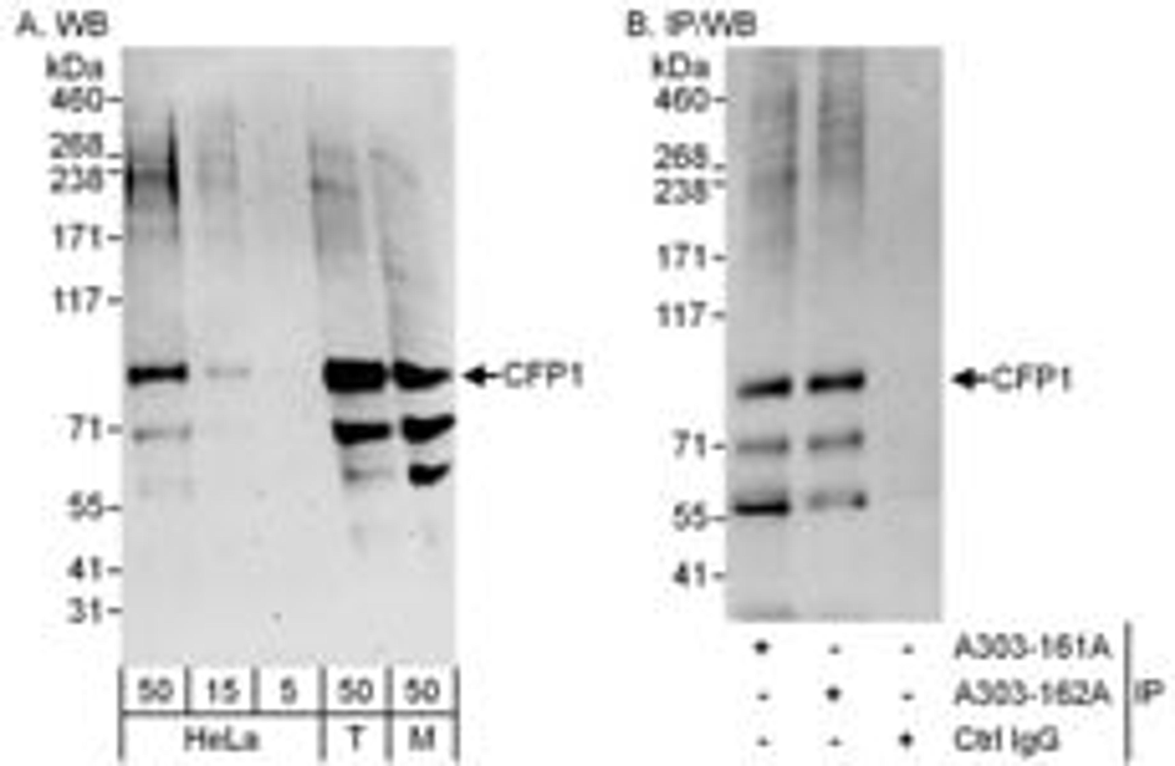 Detection of human and mouse CFP1 by western blot (h and m) and immunoprecipitation (h).