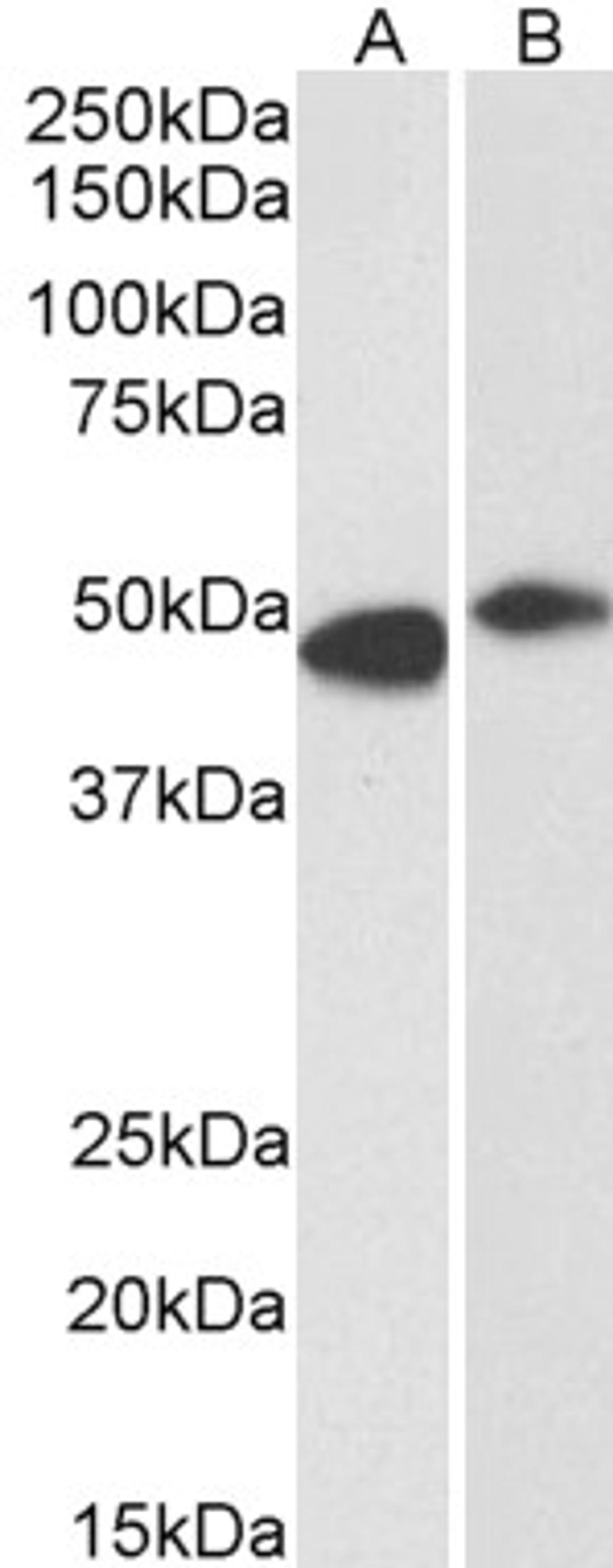 45-571 (0.3ug/ml) staining of Human Frontal Cortex (A) and Rat (B) Brain lysate (35ug protein in RIPA buffer). Primary incubation was 1 hour. Detected by chemiluminescence