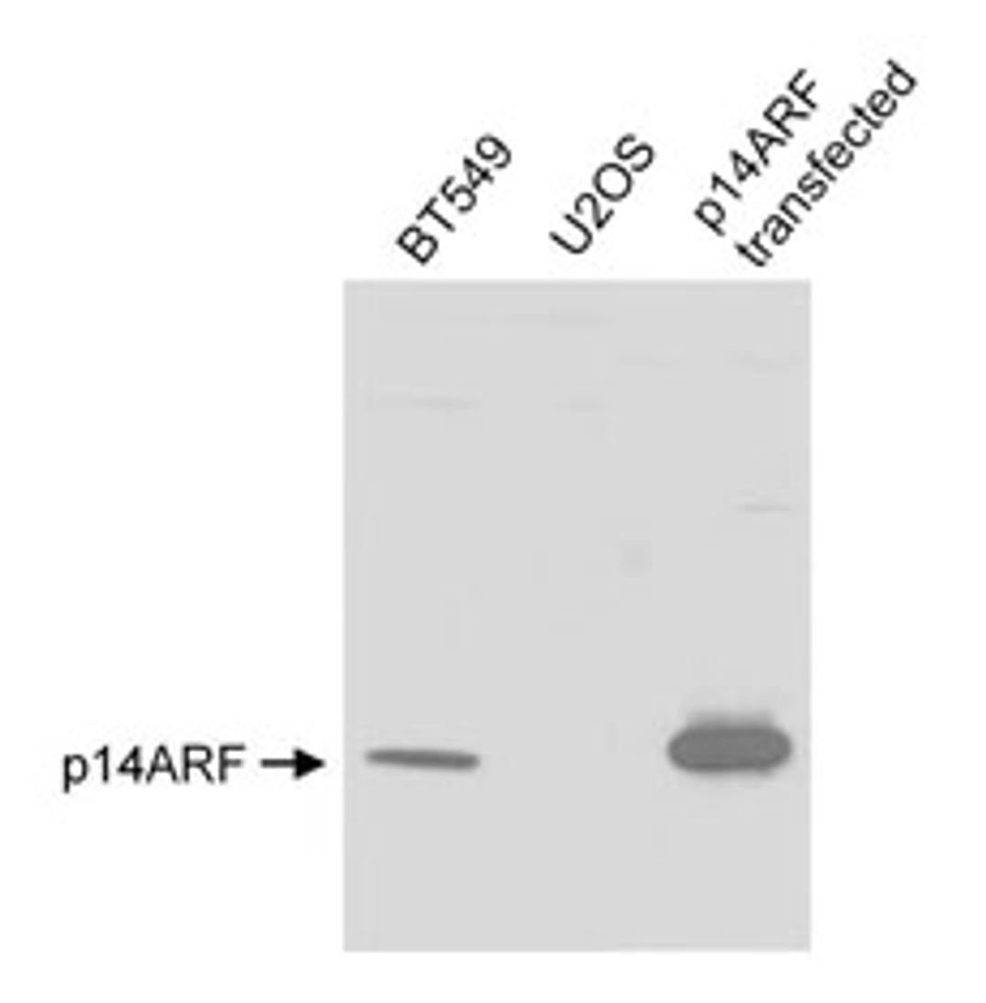 Detection of human p14ARF by western blot.