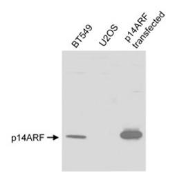 Detection of human p14ARF by western blot.