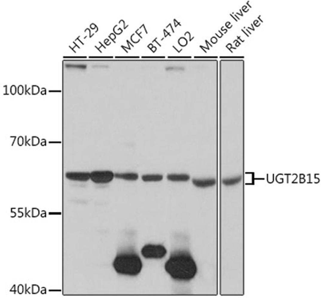 Western blot - UGT2B15 antibody (A16657)