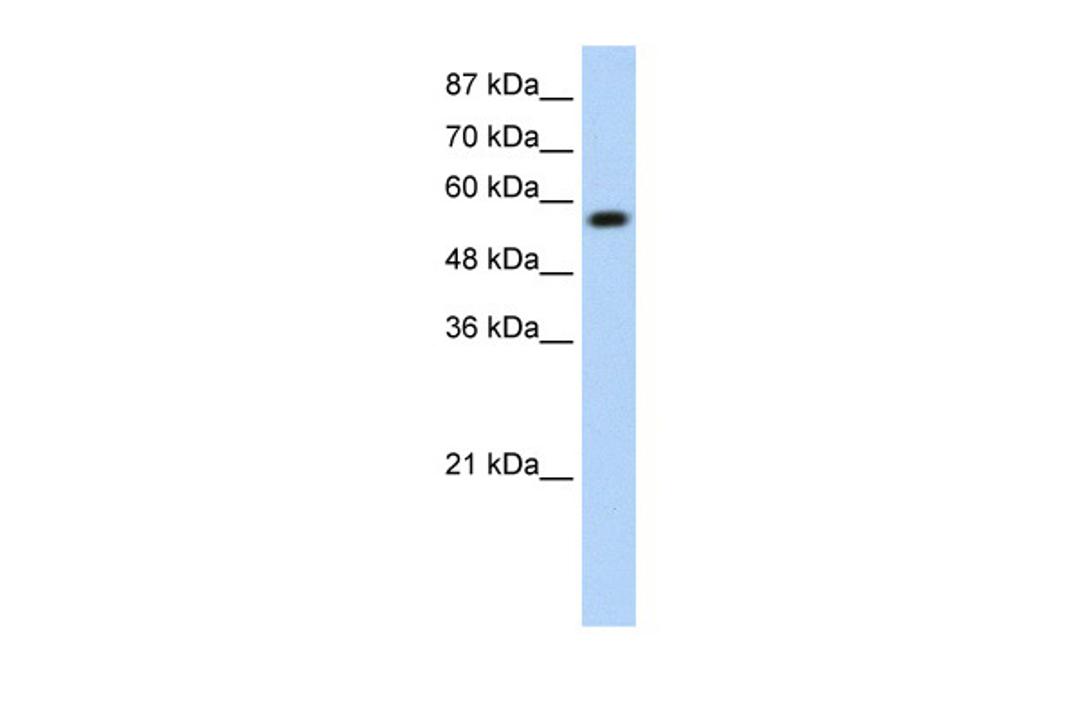 Antibody used in WB on Transfected 293T at 0.2-1 ug/ml.