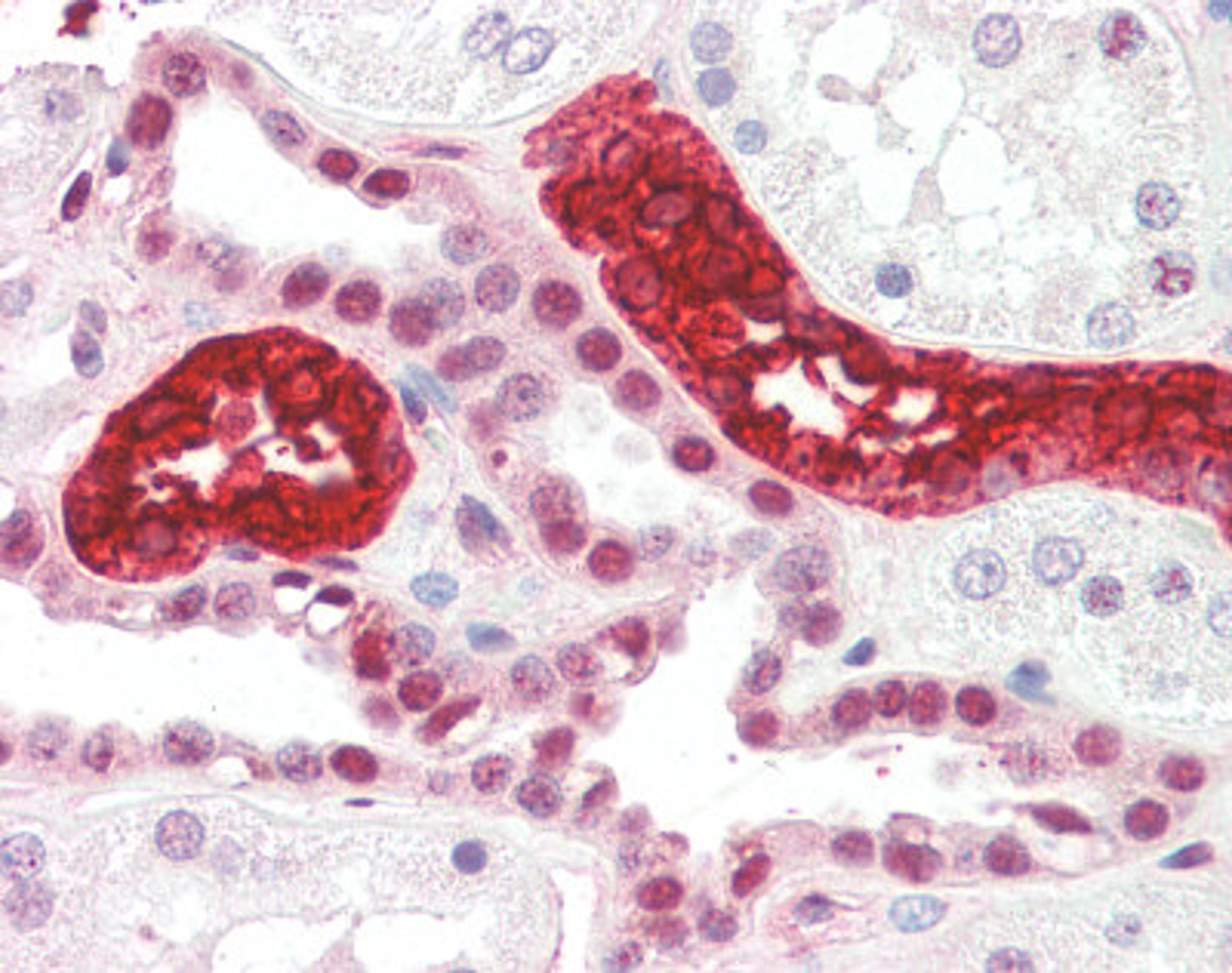 Human kidney tissue stained with Uromodulin Antibody at 1:50 followed by biotinylated anti-mouse IgG secondary antibody, alkaline phosphatase-streptavidin and chromogen.