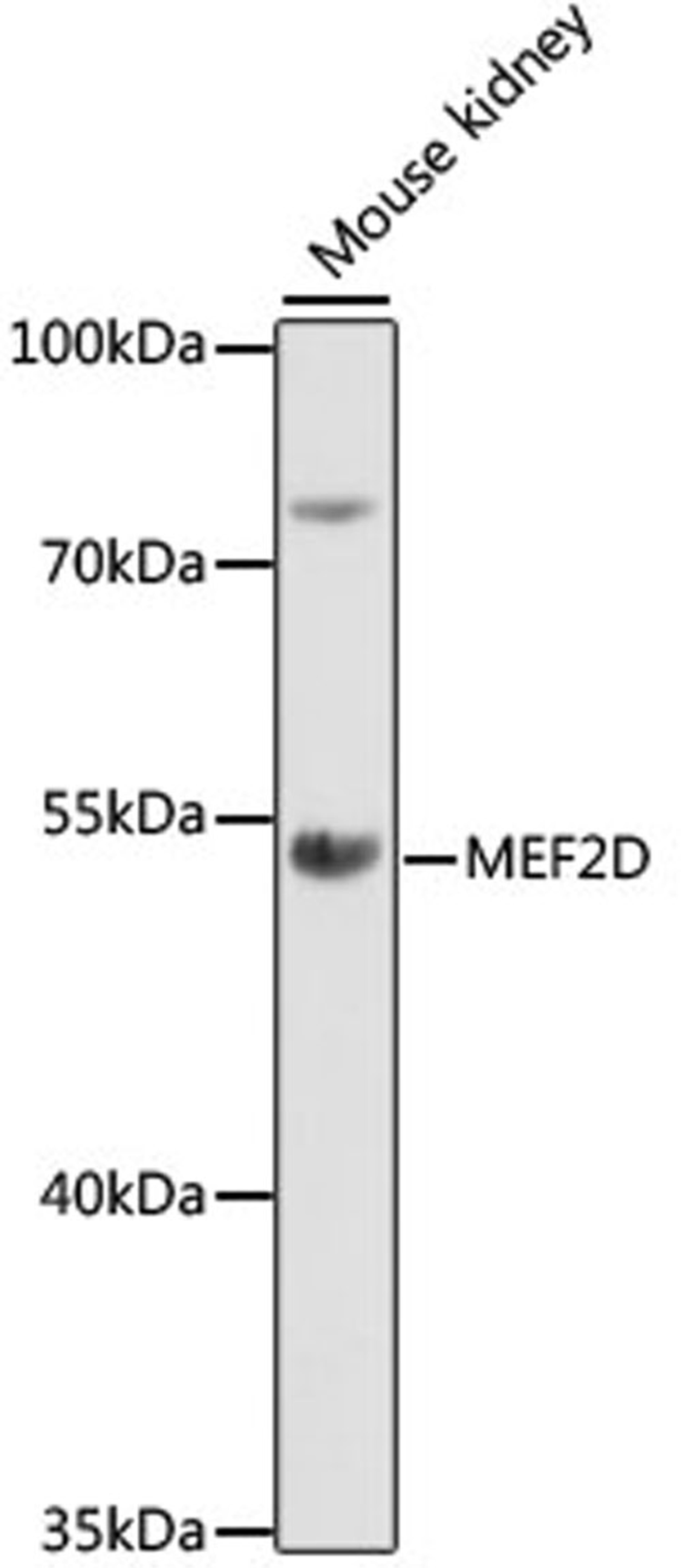 Western blot - MEF2D antibody (A16398)