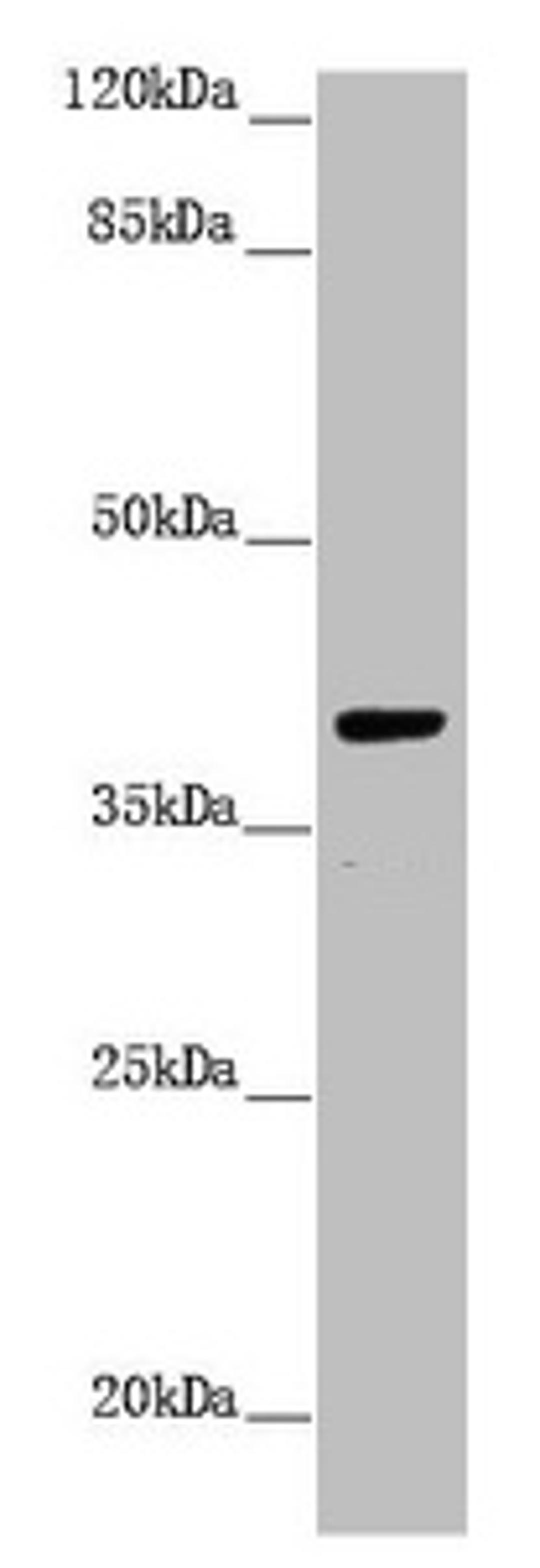 Western blot. All lanes: H2AFY antibody at 1.43µg/ml + Hela whole cell lysate. Secondary. Goat polyclonal to rabbit IgG at 1/10000 dilution. Predicted band size: 40 kDa. Observed band size: 40 kDa