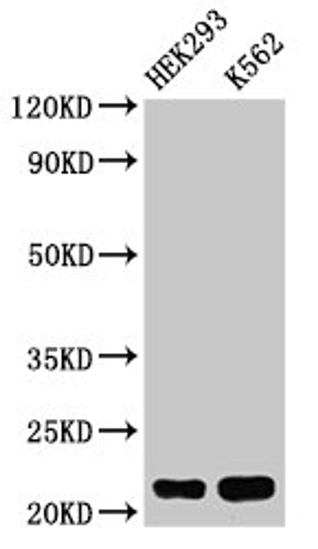 Western Blot. Positive WB detected in: HEK293 whole cell lysate, K562 whole cell lysate. All lanes: HIST1H1E antibody at 0.5µg/ml. Secondary. Goat polyclonal to rabbit IgG at 1/50000 dilution. Predicted band size: 22 kDa. Observed band size: 22 kDa