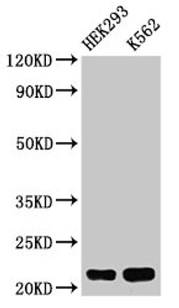 Western Blot. Positive WB detected in: HEK293 whole cell lysate, K562 whole cell lysate. All lanes: HIST1H1E antibody at 0.5µg/ml. Secondary. Goat polyclonal to rabbit IgG at 1/50000 dilution. Predicted band size: 22 kDa. Observed band size: 22 kDa
