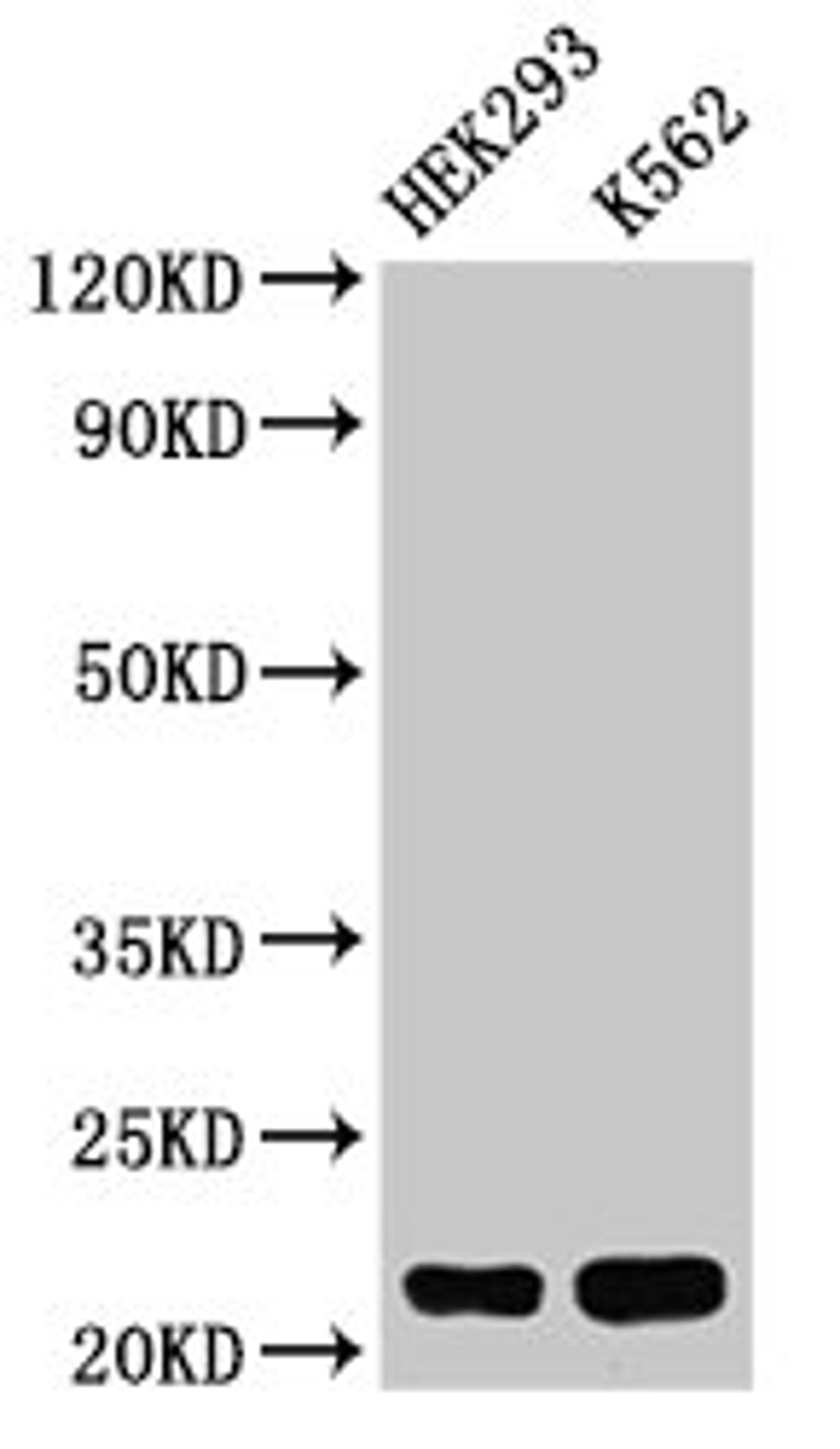 Western Blot. Positive WB detected in: HEK293 whole cell lysate, K562 whole cell lysate. All lanes: HIST1H1E antibody at 0.5µg/ml. Secondary. Goat polyclonal to rabbit IgG at 1/50000 dilution. Predicted band size: 22 kDa. Observed band size: 22 kDa