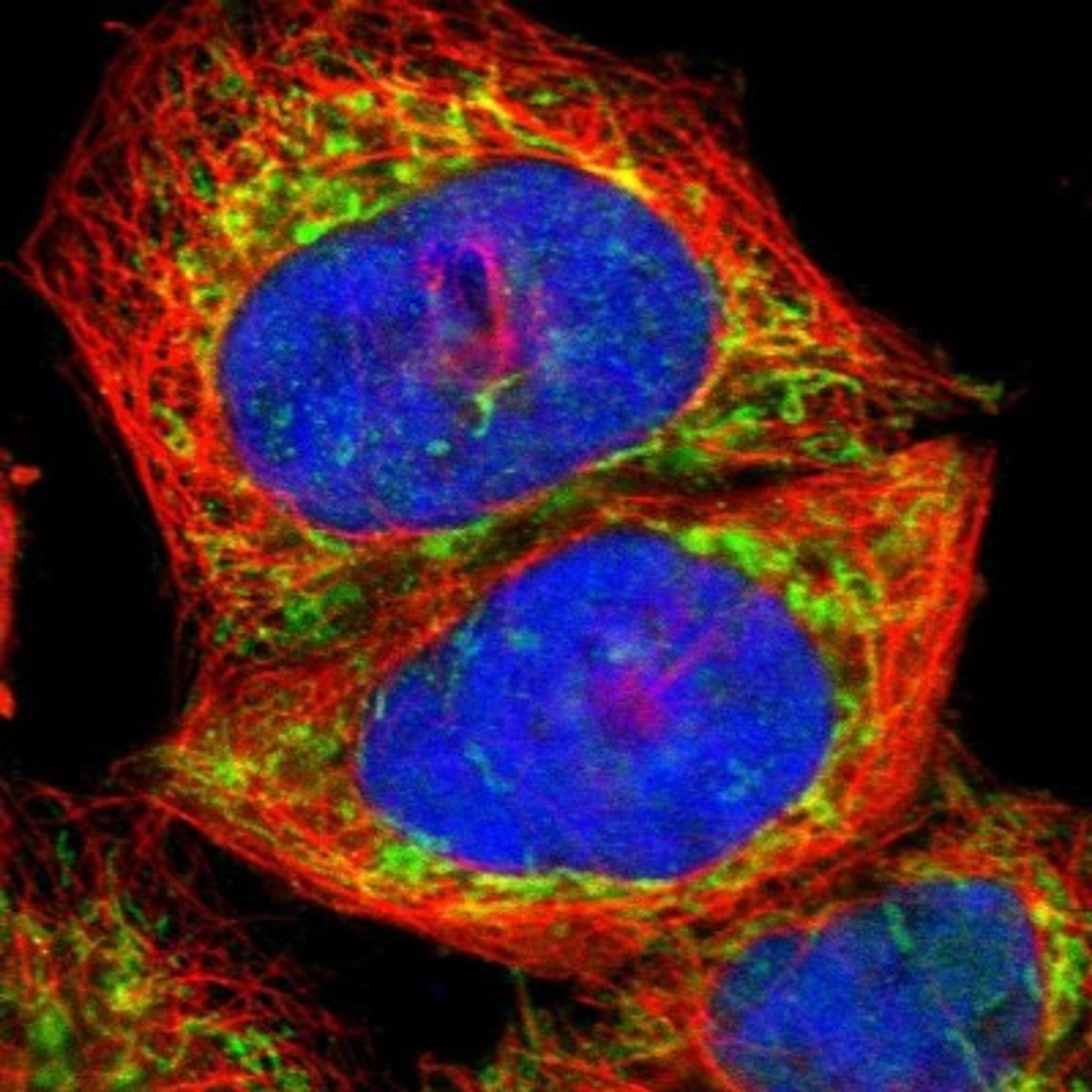 Immunocytochemistry/Immunofluorescence: APOOL Antibody [NBP1-89325] - Staining of human cell line A-431 shows positivity in mitochondria.