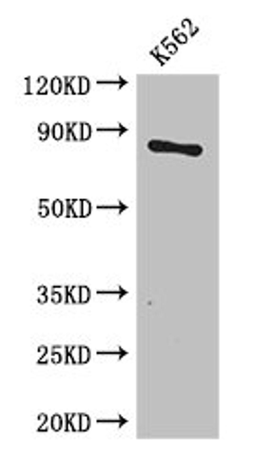Western Blot. Positive WB detected in: K562 whole cell lysate. All lanes: CPT1B antibody at 3.4ug/ml. Secondary. Goat polyclonal to rabbit IgG at 1/50000 dilution. Predicted band size: 88, 67, 84, 79 kDa. Observed band size: 88 kDa.