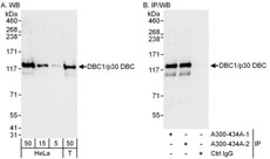 Detection of human DBC1/p30 DBC by western blot and immunoprecipitation.