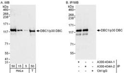 Detection of human DBC1/p30 DBC by western blot and immunoprecipitation.