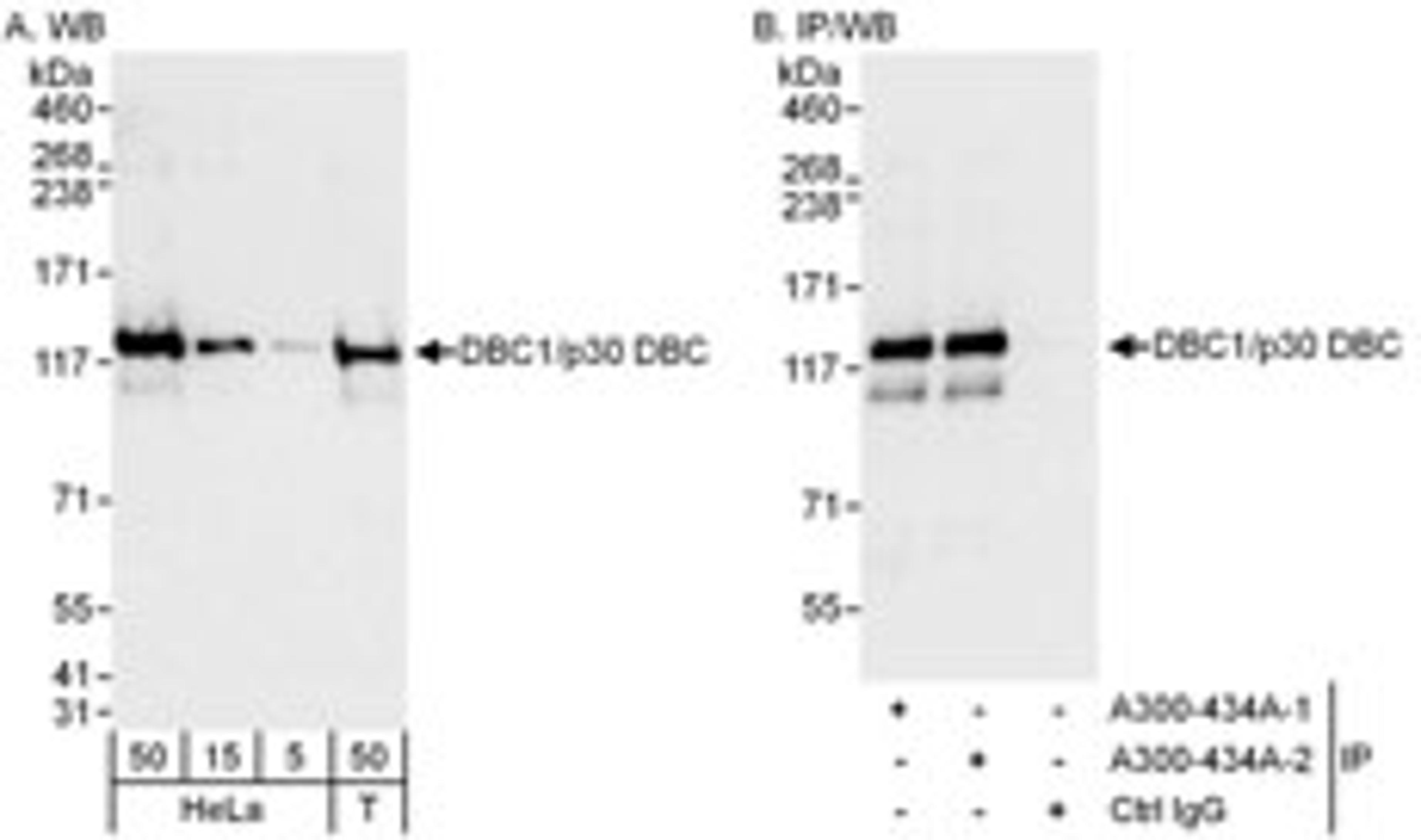 Detection of human DBC1/p30 DBC by western blot and immunoprecipitation.