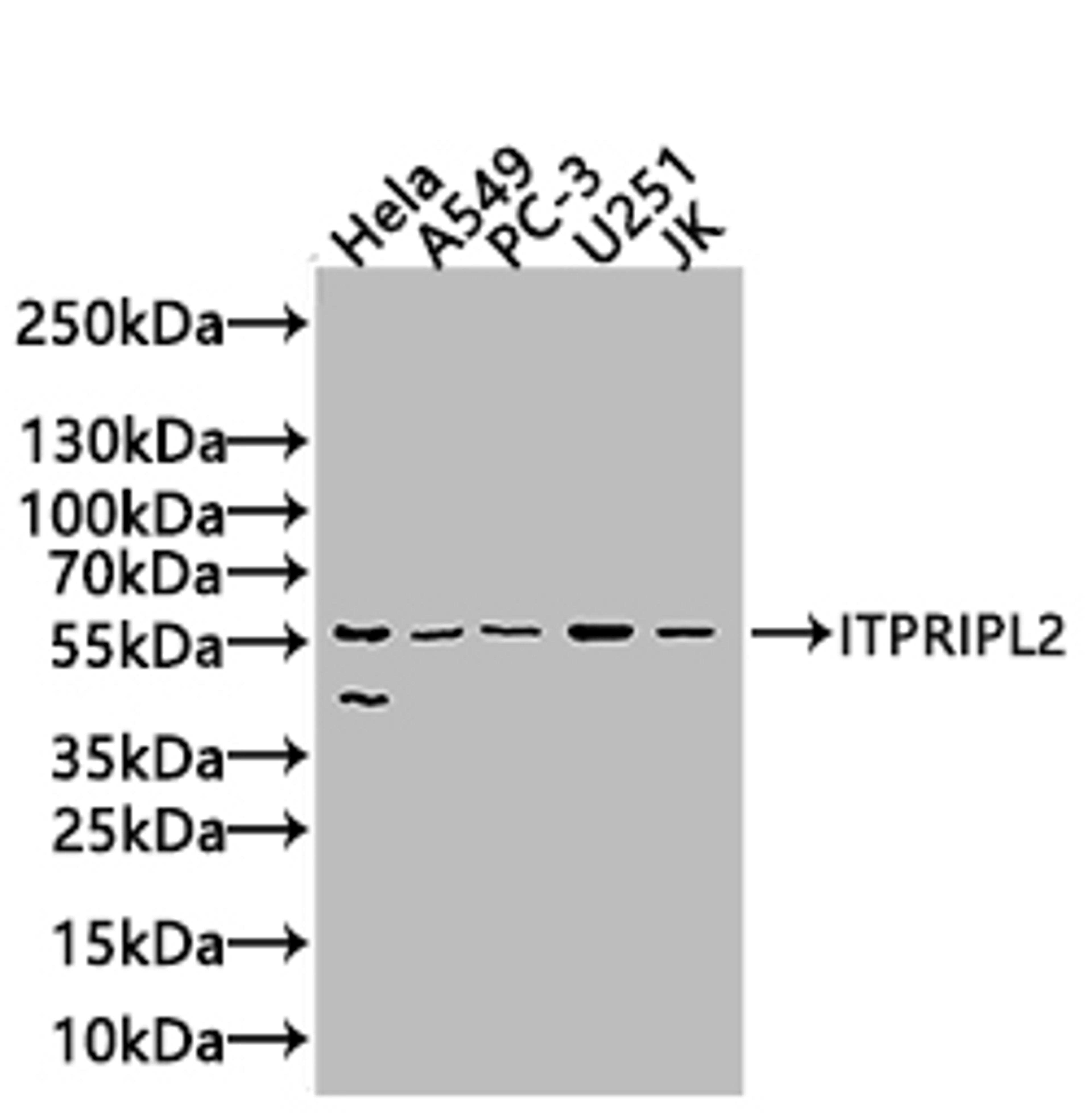 Western Blot. Positive WB detected in: MCF-7 whole cell lysate. All lanes: ITPRIPL2 antibody at 1:2000. Secondary. Goat polyclonal to rabbit IgG at 1/50000 dilution. Predicted band size: 59 kDa. Observed band size: 59 kDa. 