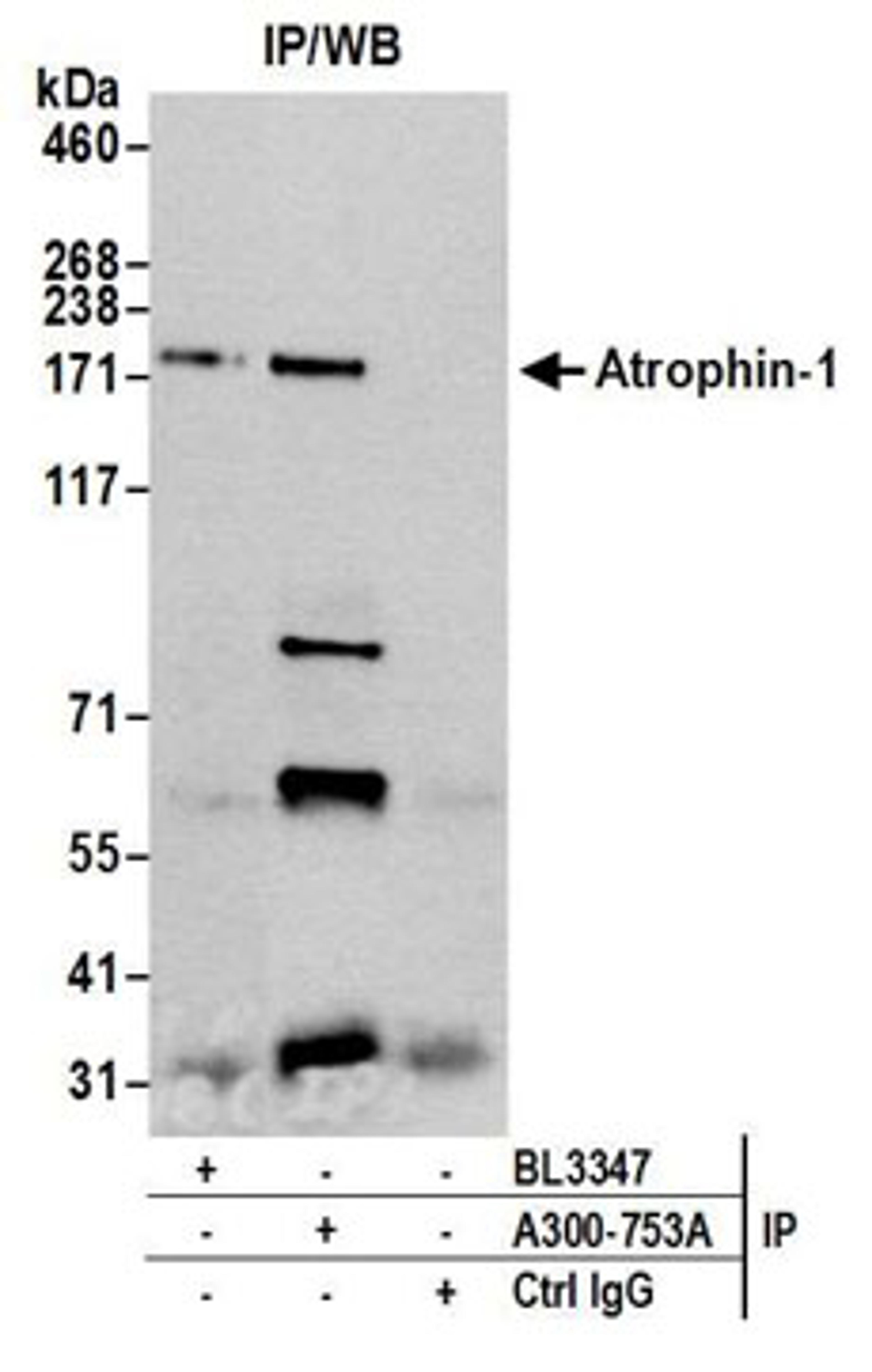 Detection of human Atrophin 1 by western blot of immunoprecipitates.