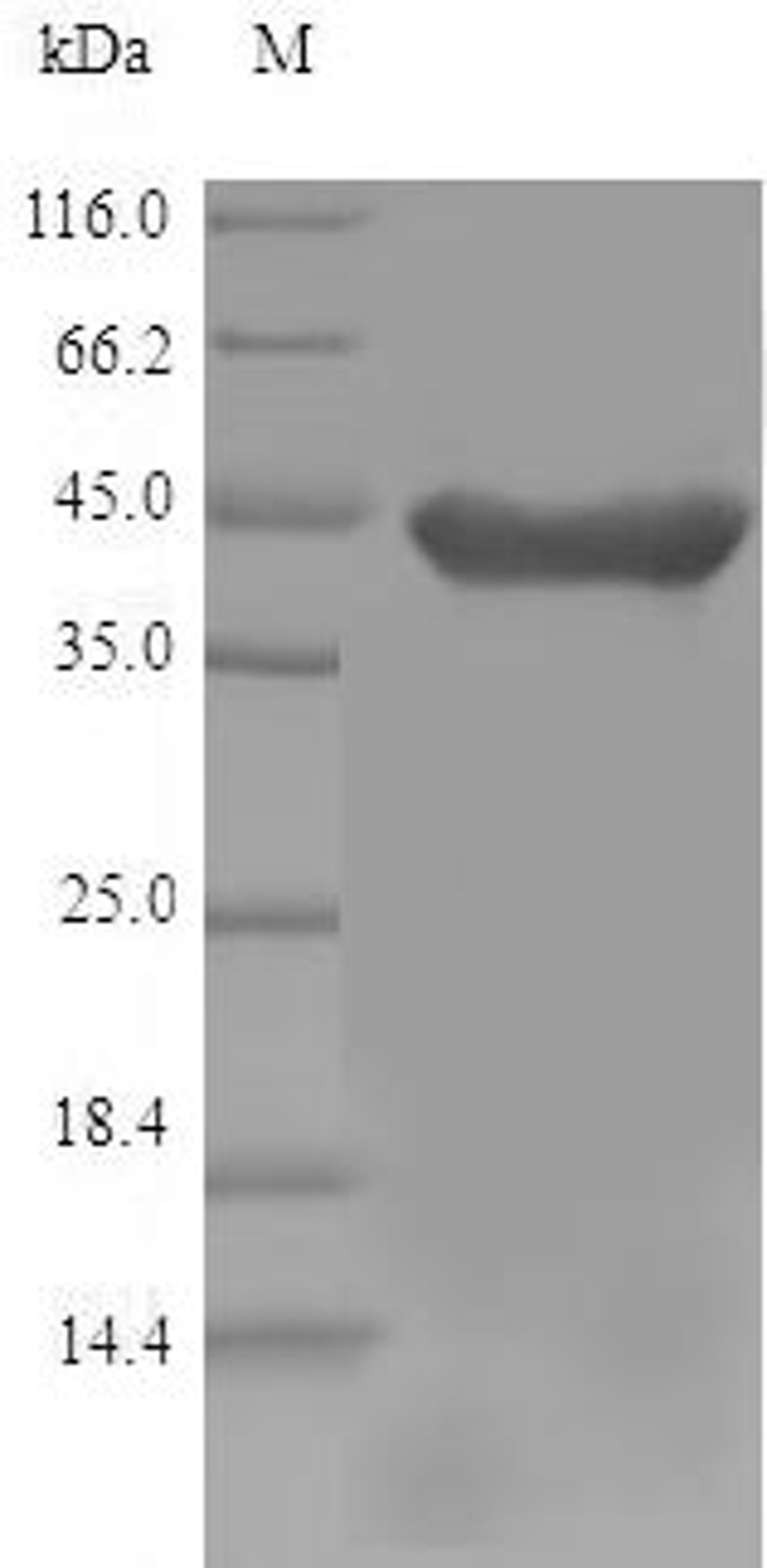 (Tris-Glycine gel) Discontinuous SDS-PAGE (reduced) with 5% enrichment gel and 15% separation gel.