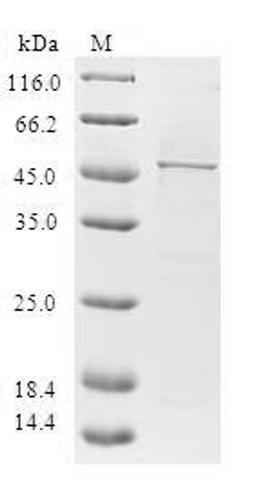 (Tris-Glycine gel) Discontinuous SDS-PAGE (reduced) with 5% enrichment gel and 15% separation gel.