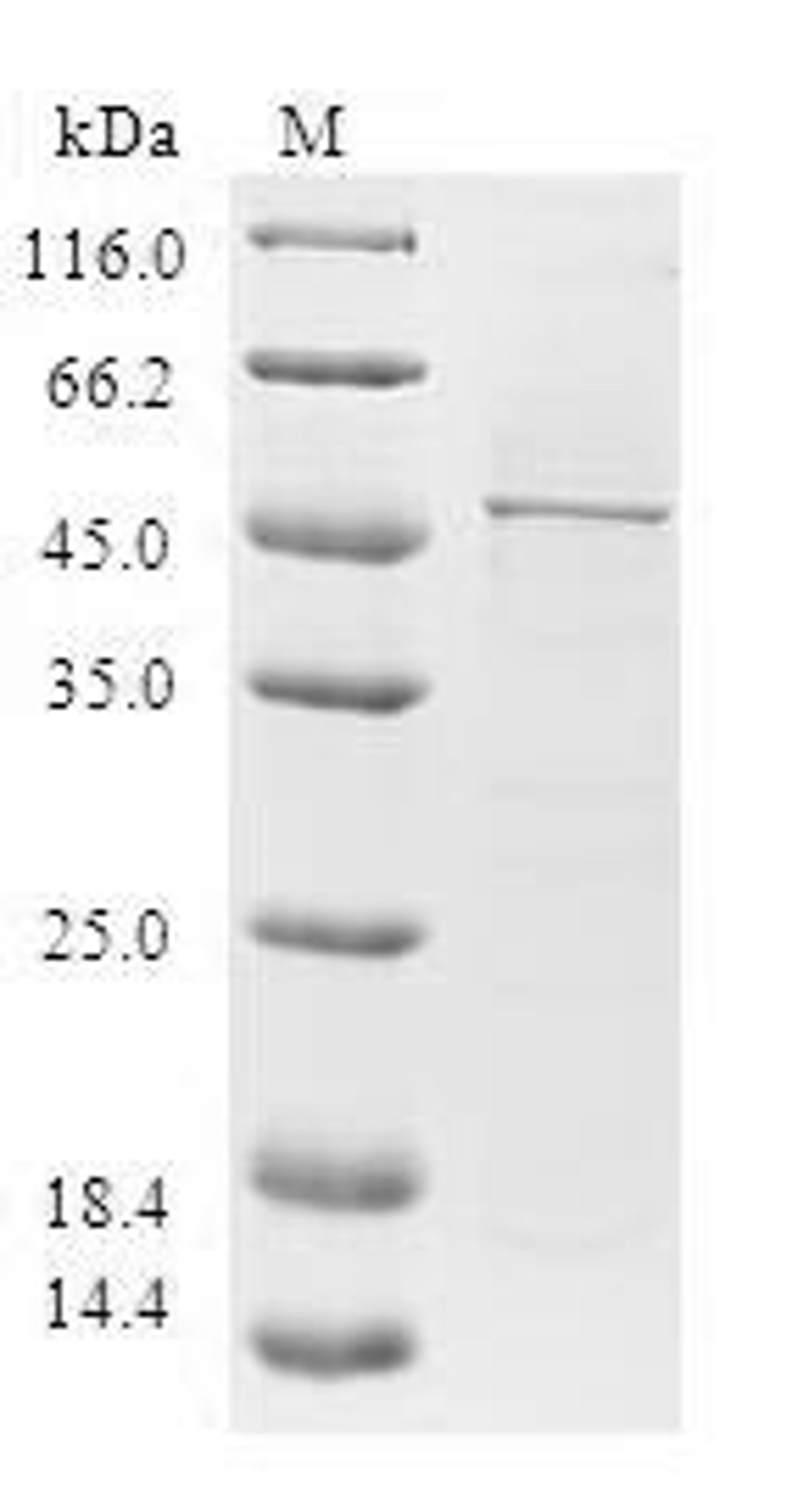 (Tris-Glycine gel) Discontinuous SDS-PAGE (reduced) with 5% enrichment gel and 15% separation gel.