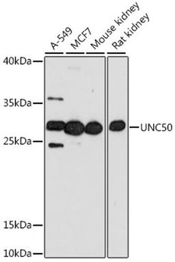 Western blot - UNC50 antibody (A16114)