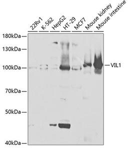 Western blot - VIL1 antibody (A5494)