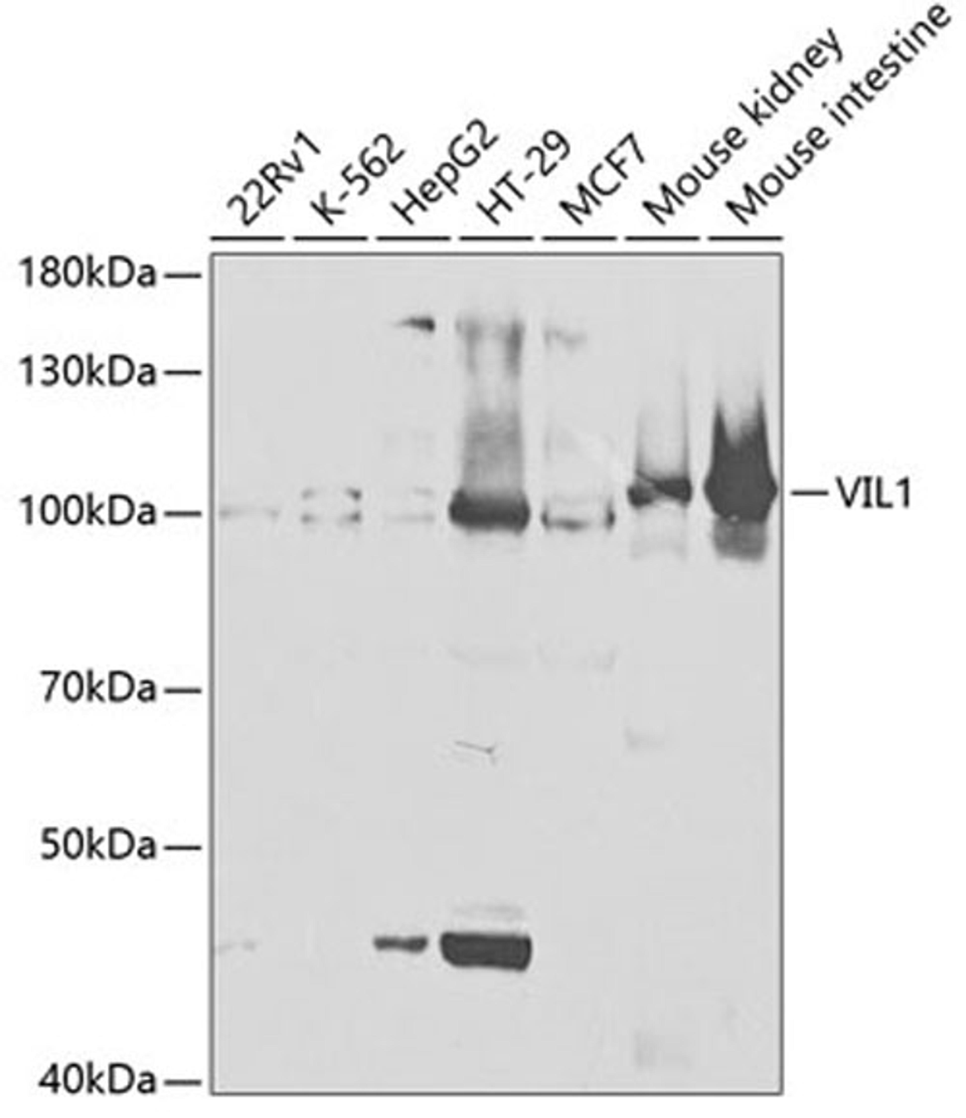 Western blot - VIL1 antibody (A5494)