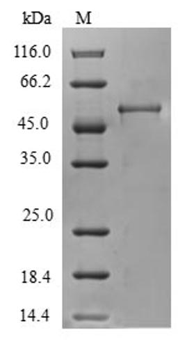 (Tris-Glycine gel) Discontinuous SDS-PAGE (reduced) with 5% enrichment gel and 15% separation gel.