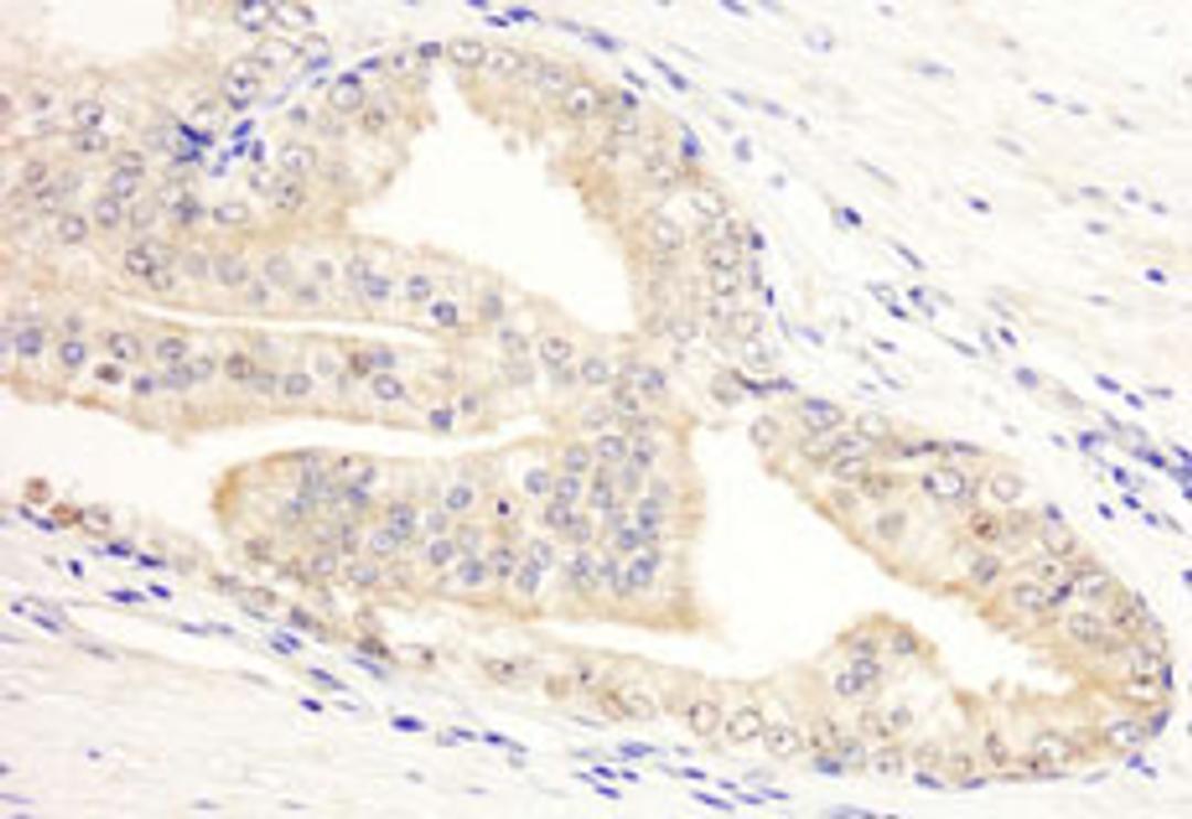 Detection of human KANK2/SIP by immunohistochemistry.