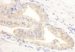 Detection of human KANK2/SIP by immunohistochemistry.