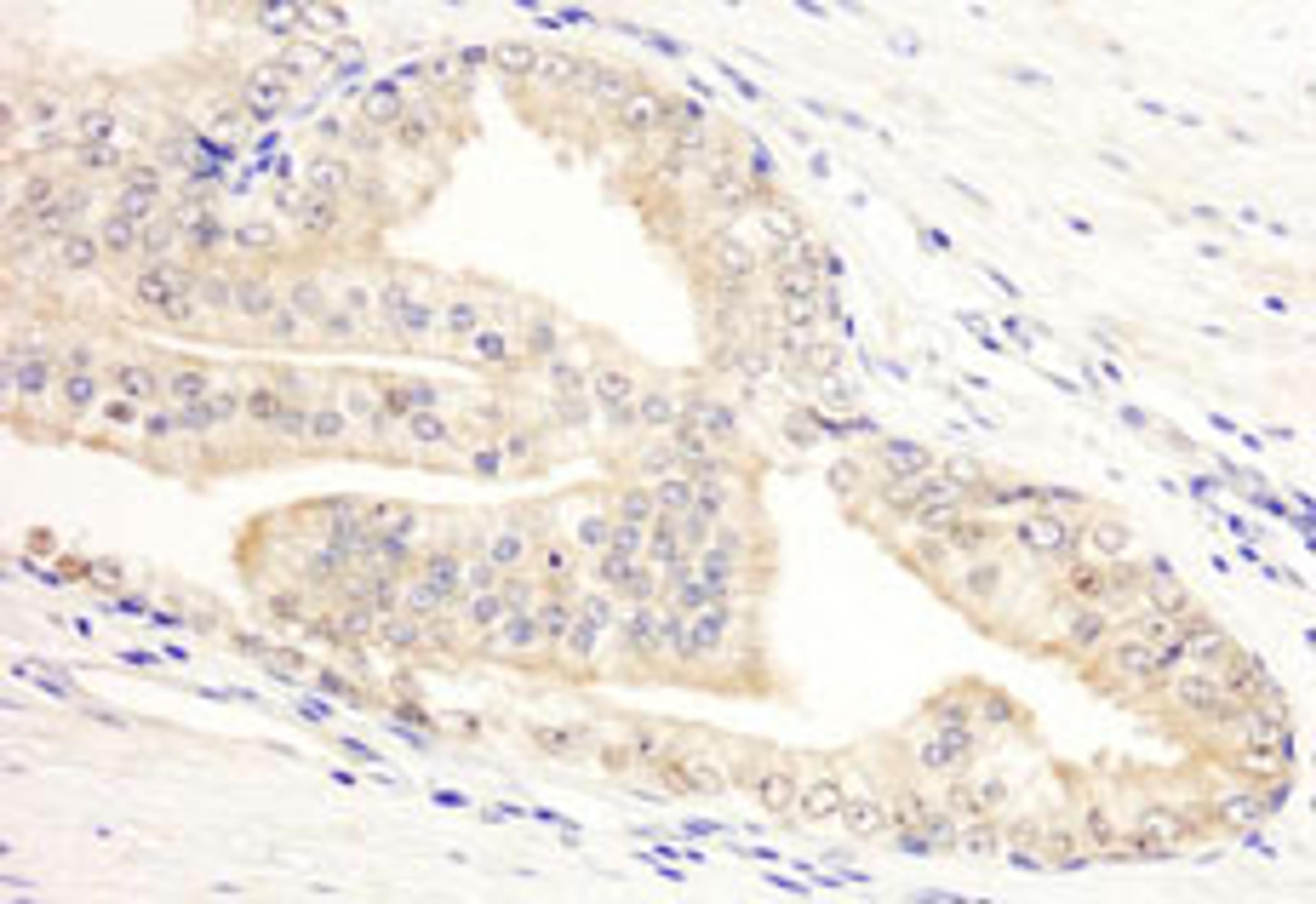 Detection of human KANK2/SIP by immunohistochemistry.