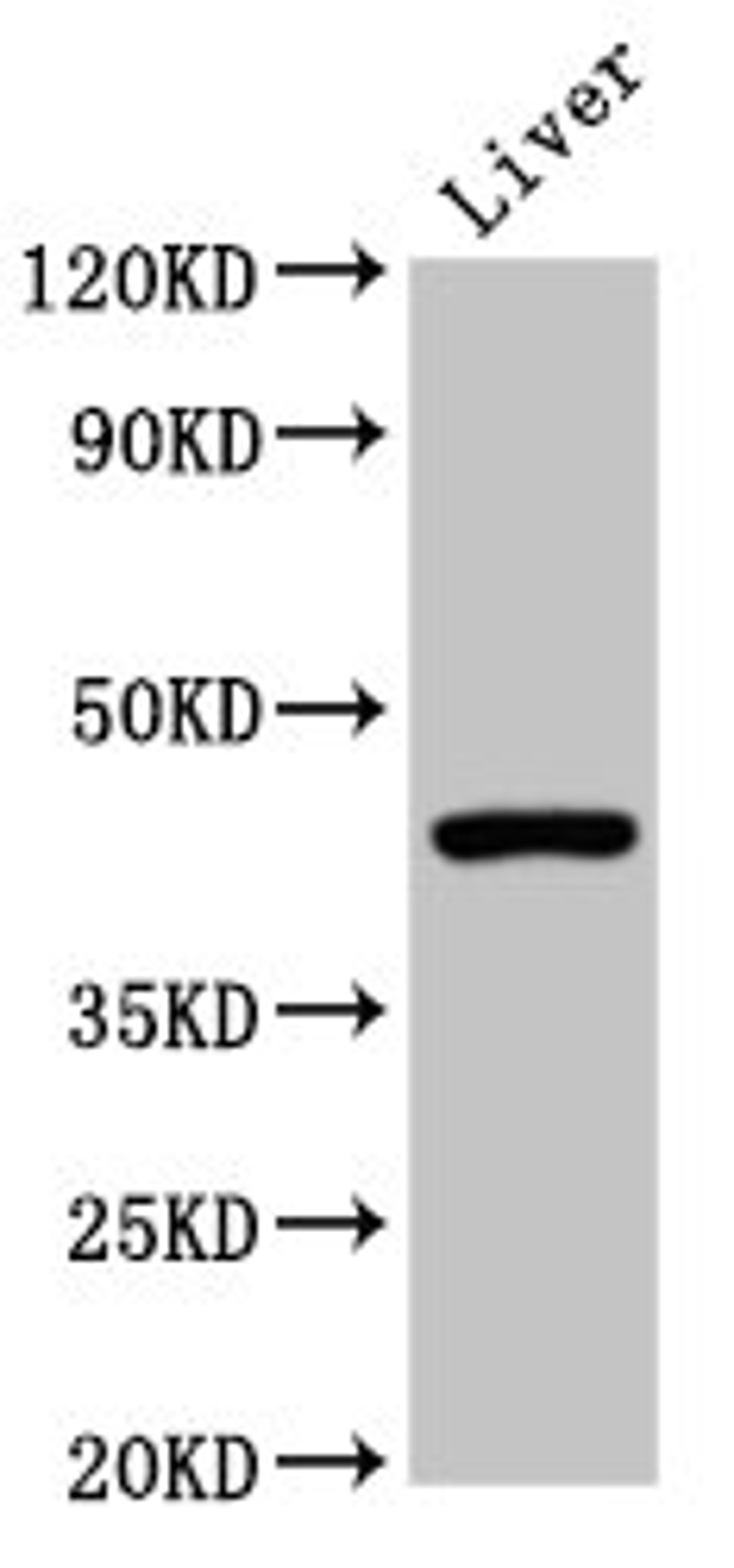 Western Blot. Positive WB detected in: Mouse liver tissue. All lanes: CLEC4M antibody at 2ug/ml. Secondary. Goat polyclonal to rabbit IgG at 1/50000 dilution. Predicted band size: 46, 31, 37, 27, 38, 29, 43, 34, 25 kDa. Observed band size: 46 kDa.