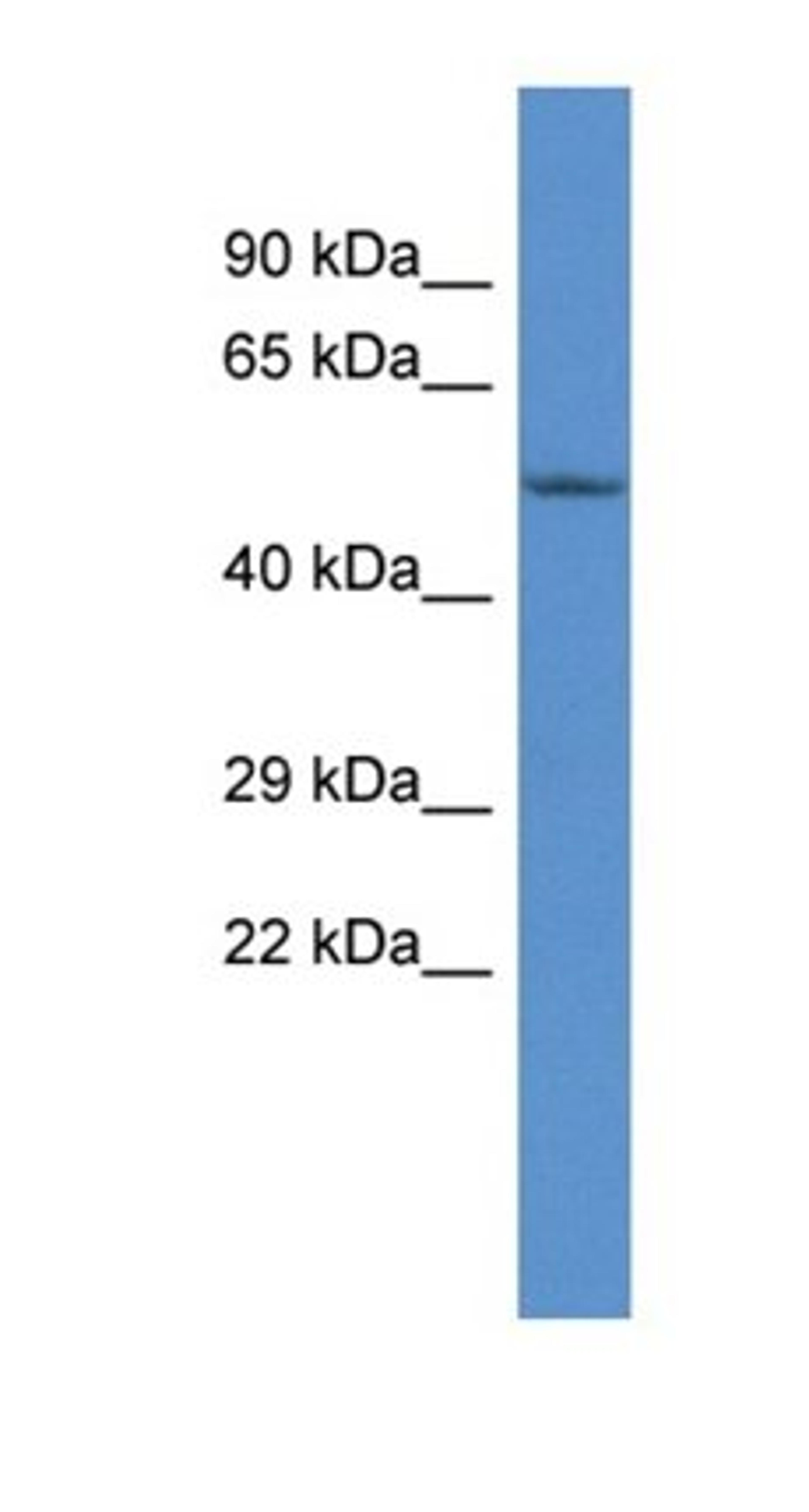 Western blot analysis of mouse Brain tissue using Shpk antibody