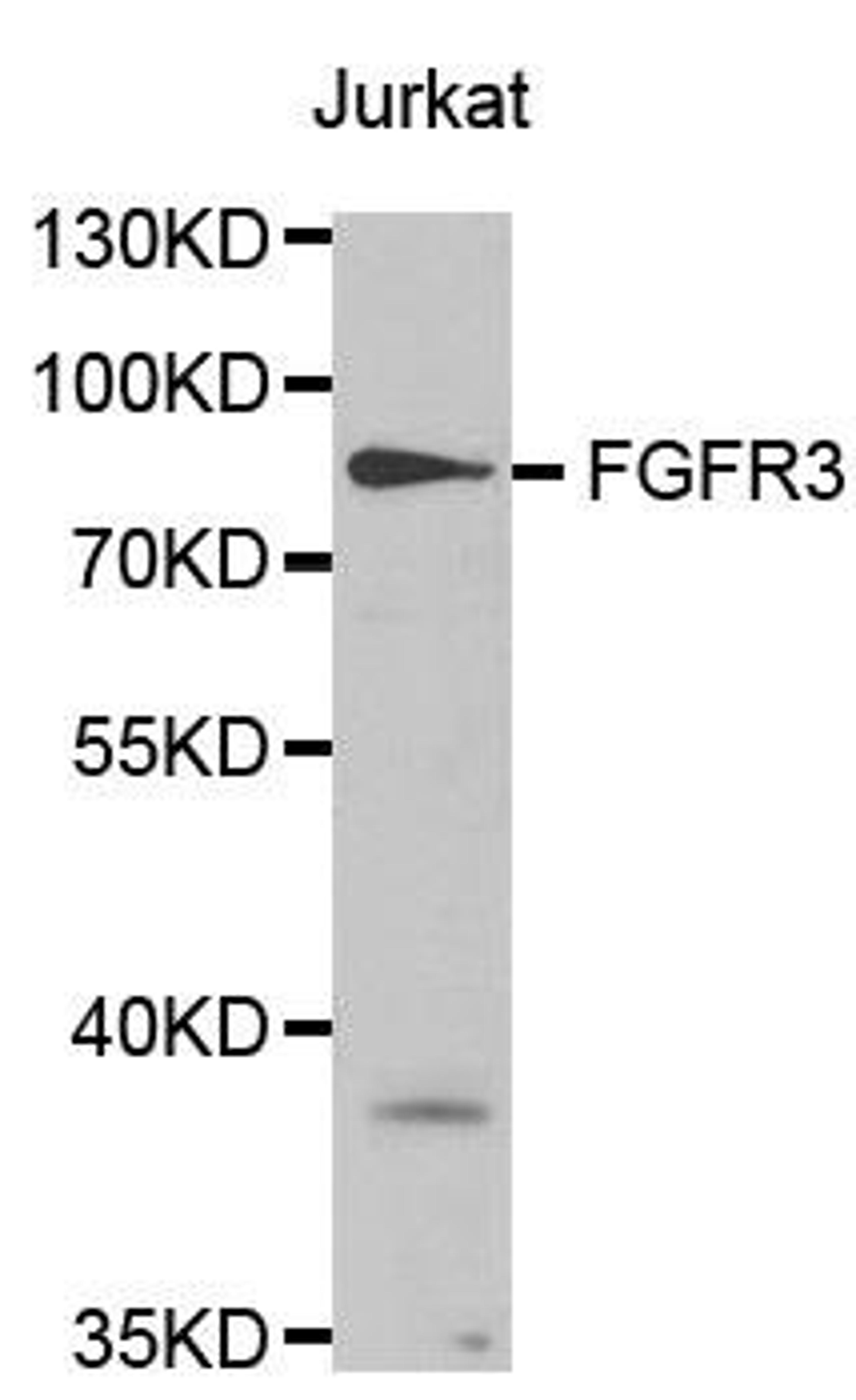 Western blot analysis of extracts of Jurkat cell lines using FGF Receptor 3 antibody