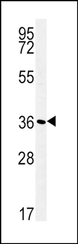 Western blot analysis in WiDr cell line lysates (35ug/lane).