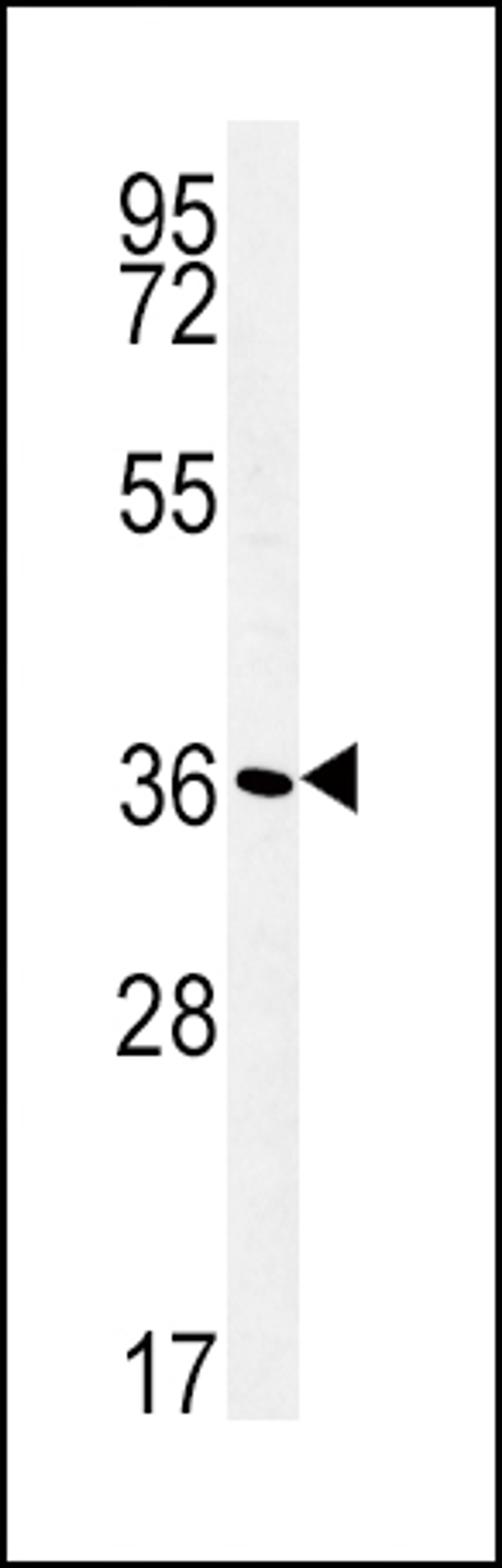 Western blot analysis in WiDr cell line lysates (35ug/lane).