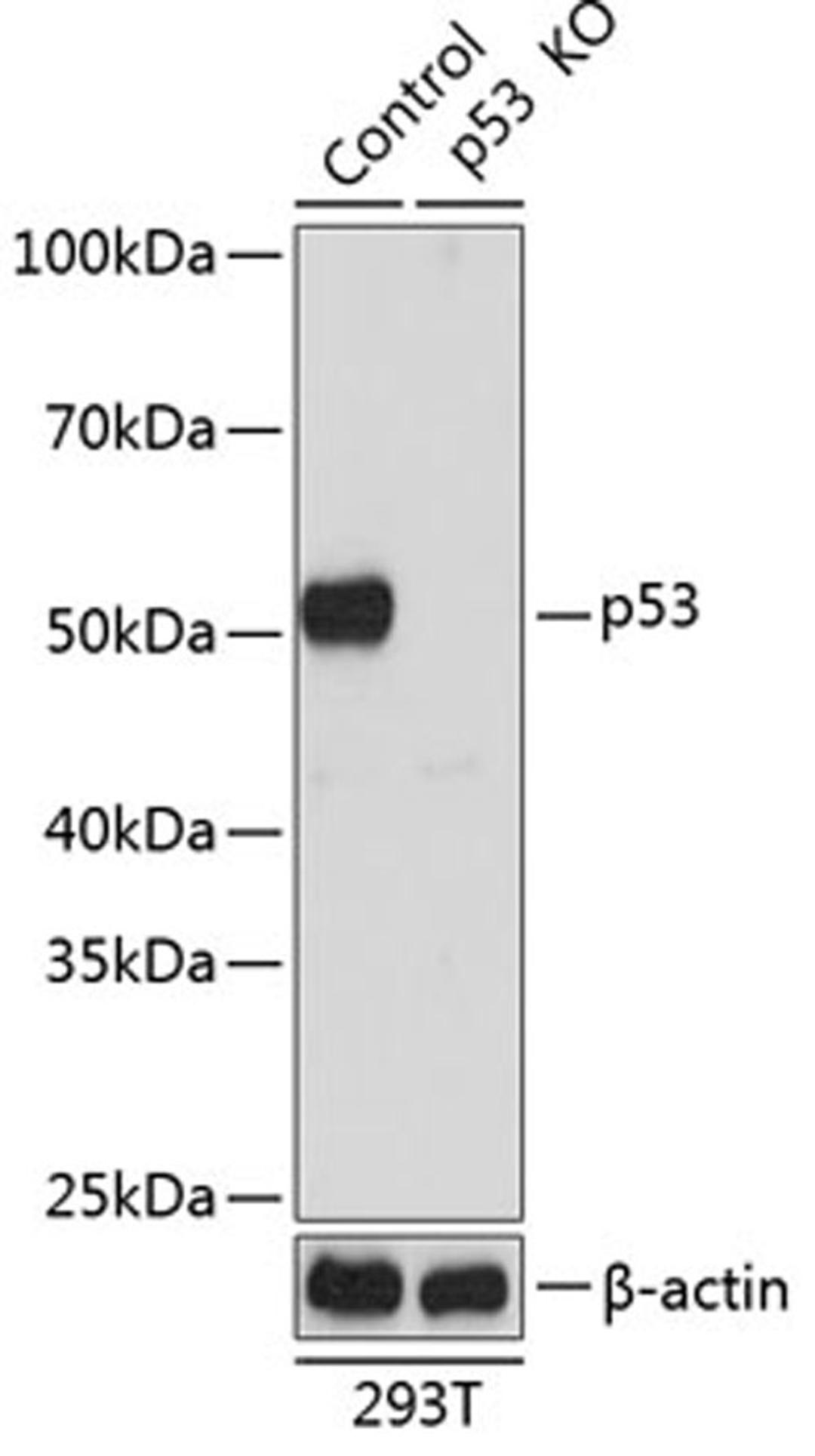 Western blot - p53 antibody (A19585)