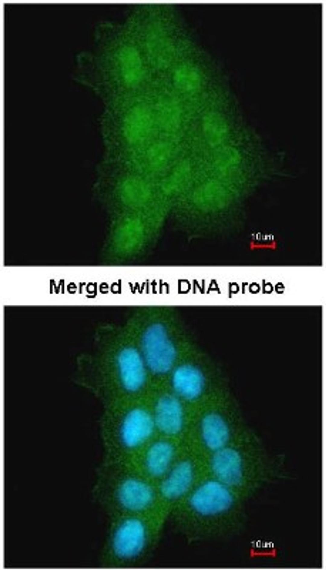 Immunocytochemistry/Immunofluorescence: MAGEA11 Antibody [NBP1-31210] - Analysis of A431, using MAGEA11 antibody at 1:500 dilution.