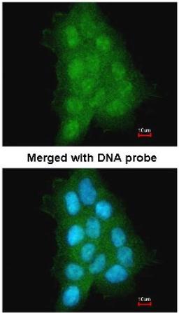 Immunocytochemistry/Immunofluorescence: MAGEA11 Antibody [NBP1-31210] - Analysis of A431, using MAGEA11 antibody at 1:500 dilution.