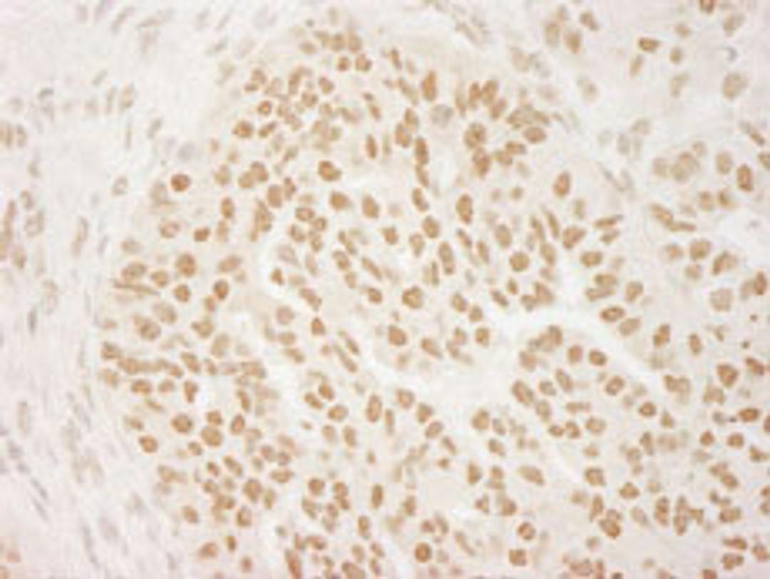 Detection of human PRMT6 by immunohistochemistry.