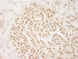 Detection of human PRMT6 by immunohistochemistry.