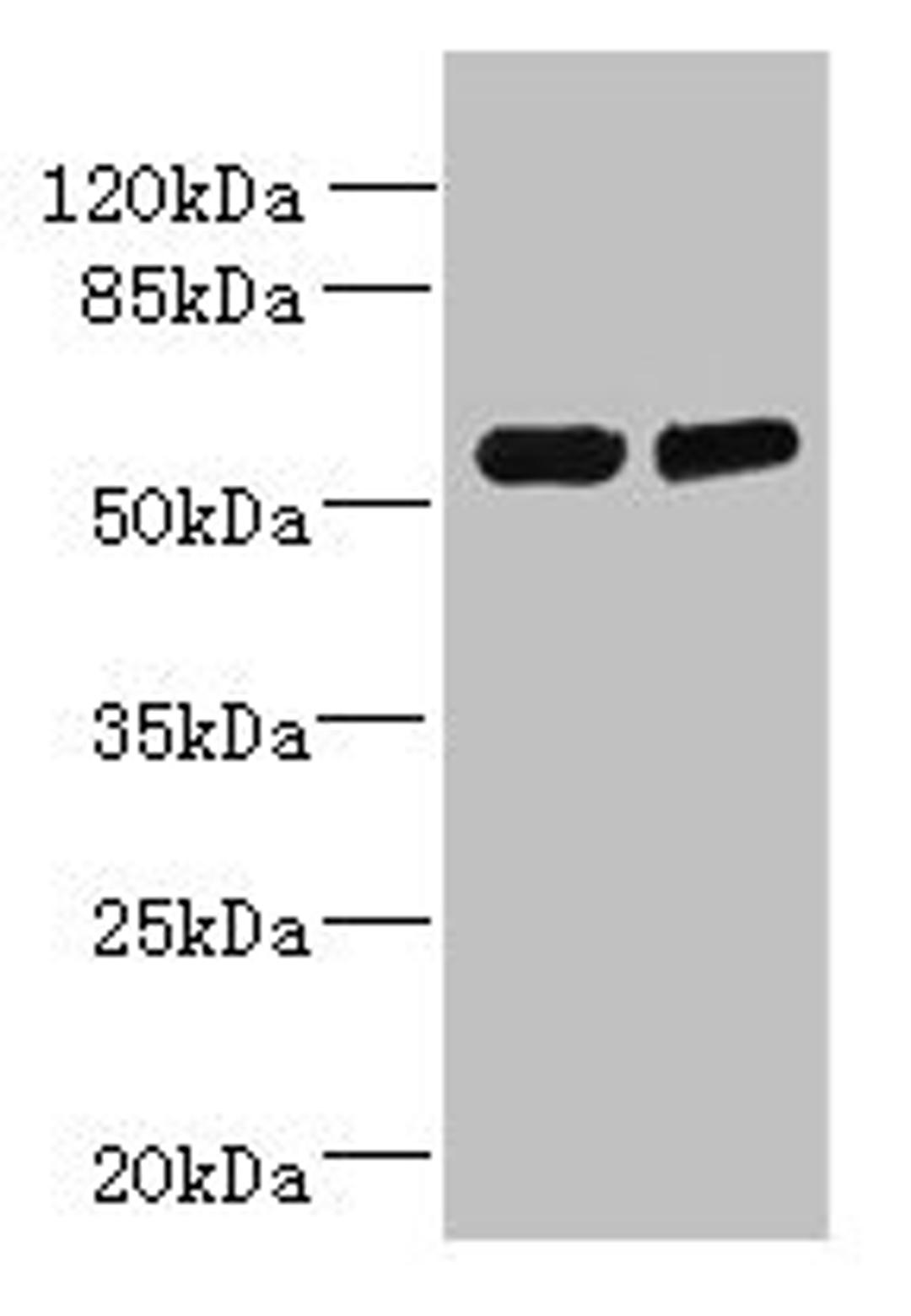 Western blot. All lanes: TCTE1 antibody at 3µg/ml. Lane 1: U251 whole cell lysate. Lane 2: Mouse brain tissue. Secondary. Goat polyclonal to rabbit IgG at 1/10000 dilution. Predicted band size: 56 kDa. Observed band size: 56 kDa
