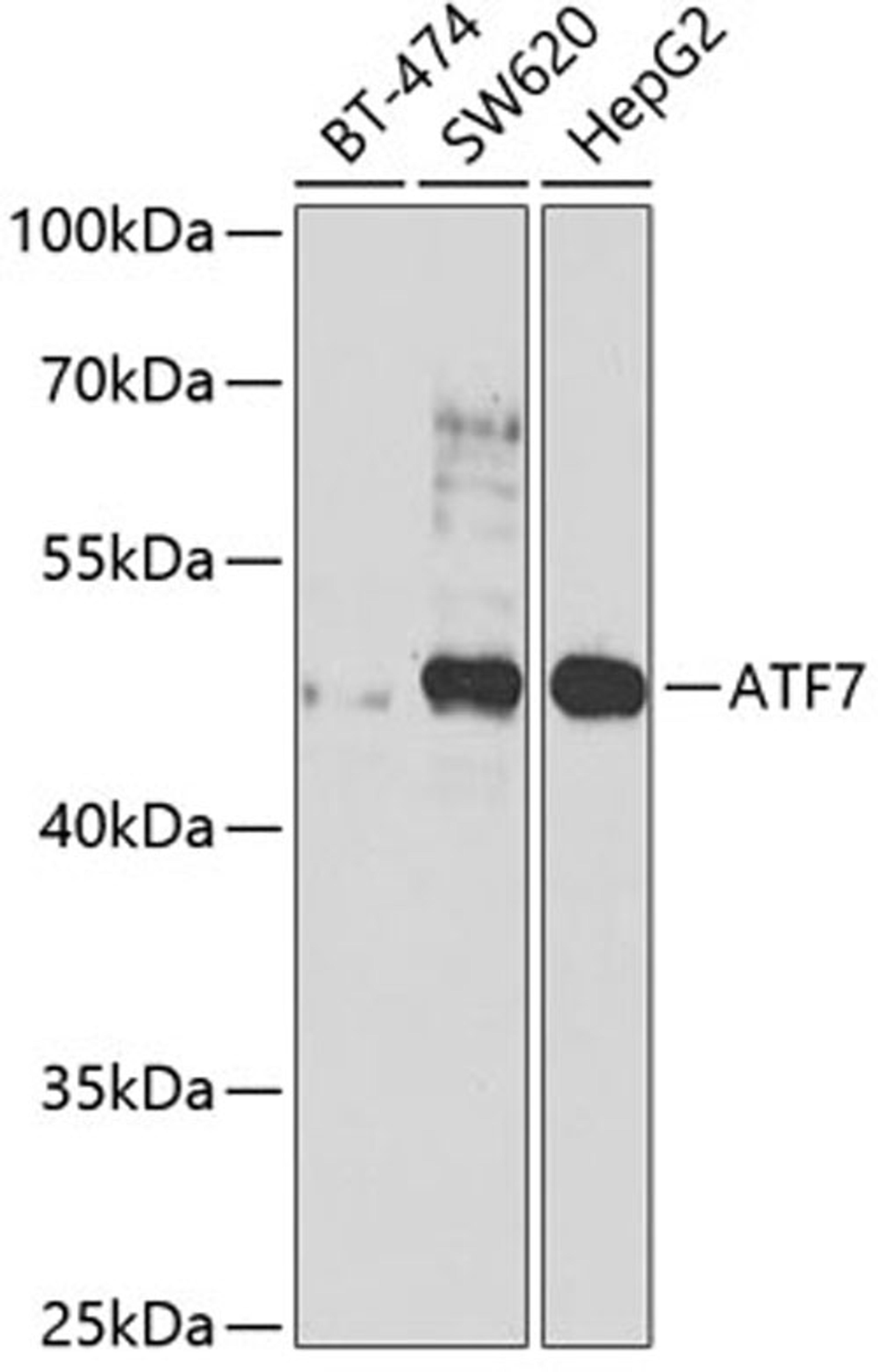 Western blot - ATF7 antibody (A7580)