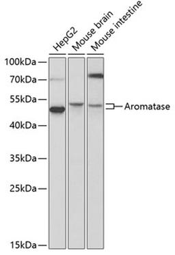 Western blot - Aromatase antibody (A2161)