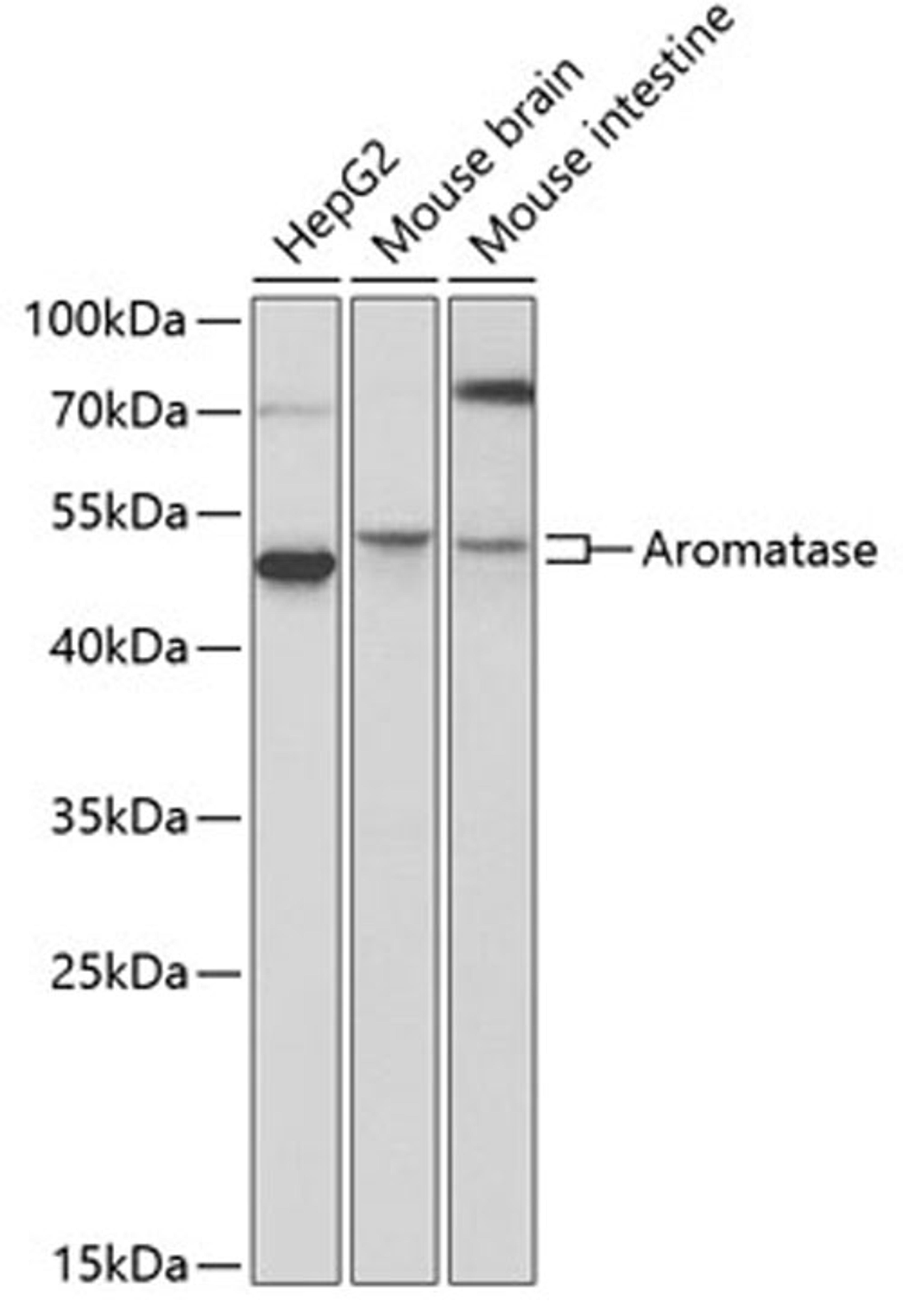 Western blot - Aromatase antibody (A2161)