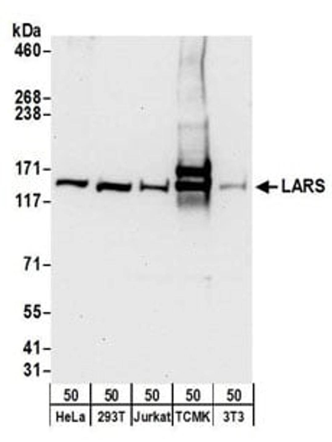 Detection of human and mouse LARS by western blot.