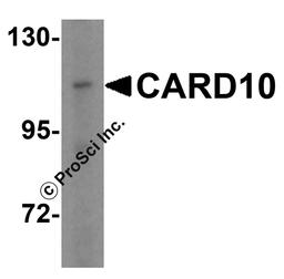 Western blot analysis of CARD10 in A-20 cell lysate with CARD10 antibody at 5 μg/mL.