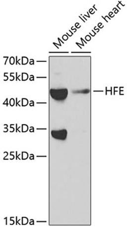 Western blot - HFE antibody (A1310)