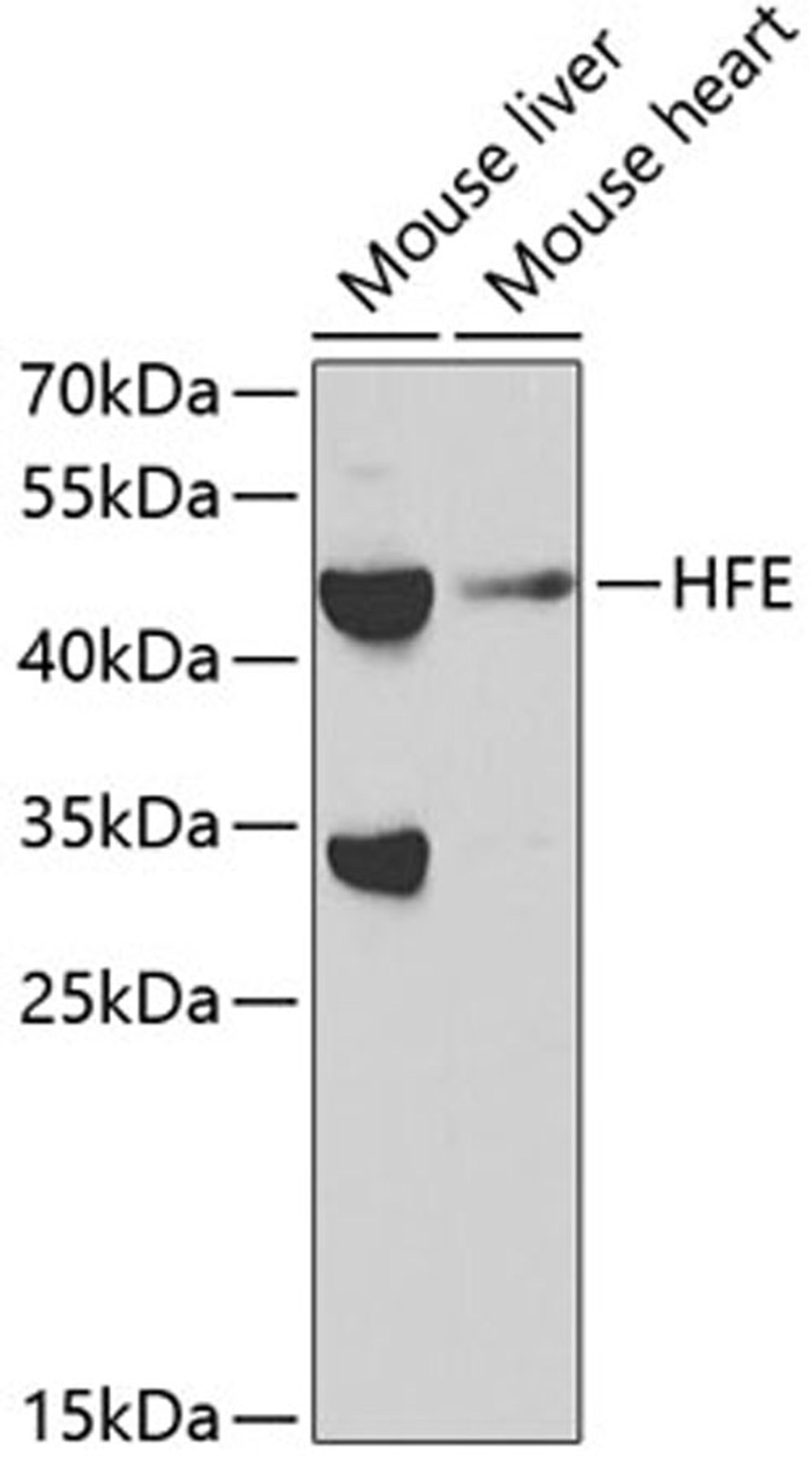 Western blot - HFE antibody (A1310)